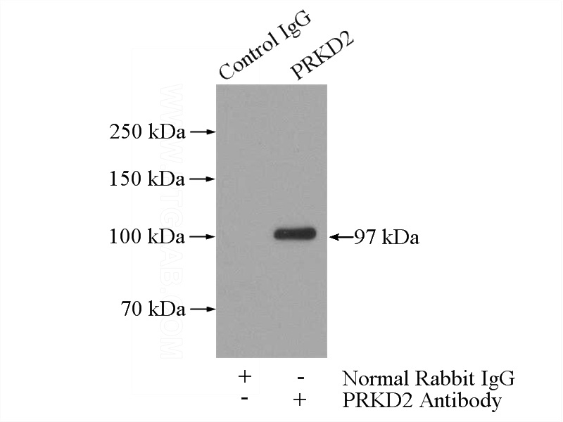 IP Result of anti-PRKD2 (IP:Catalog No:114201, 4ug; Detection:Catalog No:114201 1:500) with HeLa cells lysate 1200ug.