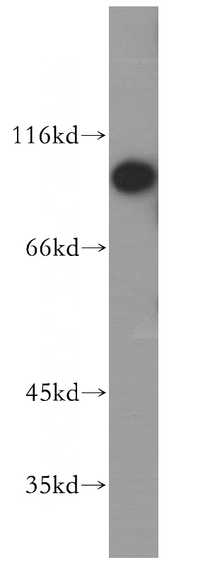 HeLa cells were subjected to SDS PAGE followed by western blot with Catalog No:112247(SLC39A6 antibody) at dilution of 1:1000