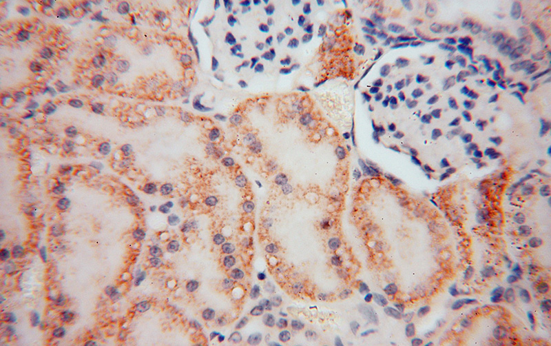 Immunohistochemical of paraffin-embedded human kidney using Catalog No:114688(RENALASE antibody) at dilution of 1:100 (under 40x lens)