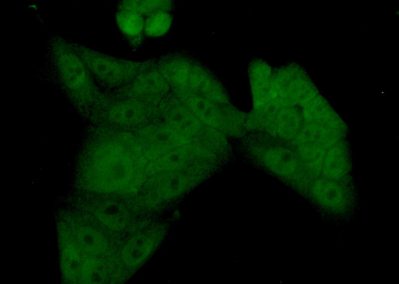 Immunofluorescent analysis of (10% Formaldehyde) fixed HeLa cells using Catalog No:114636(RFXAP Antibody) at dilution of 1:50 and Alexa Fluor 488-congugated AffiniPure Goat Anti-Rabbit IgG(H+L)