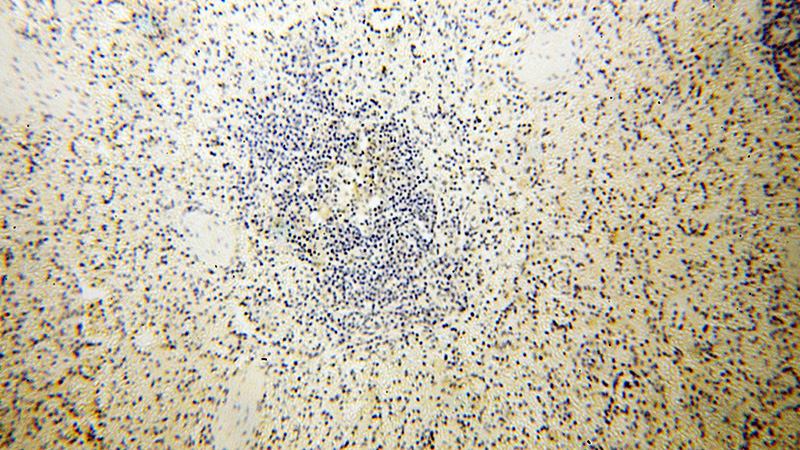 Immunohistochemical of paraffin-embedded human spleen using Catalog No:113769(PFKFB2 antibody) at dilution of 1:100 (under 10x lens)