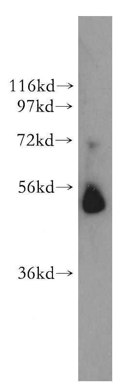 A375 cells were subjected to SDS PAGE followed by western blot with Catalog No:110831(Galc antibody) at dilution of 1:300
