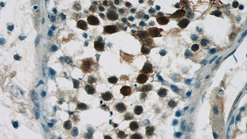 Immunohistochemistry of paraffin-embedded human testis tissue slide using Catalog No:116565(UIMC1 Antibody) at dilution of 1:50 (under 40x lens)