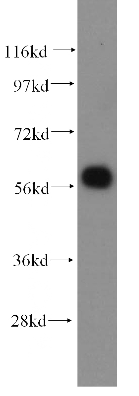 MCF7 cells were subjected to SDS PAGE followed by western blot with Catalog No:108188(ARHGEF5 antibody) at dilution of 1:500