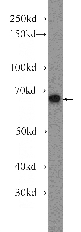 Raji cells were subjected to SDS PAGE followed by western blot with Catalog No:116923(ZC3H12A Antibody) at dilution of 1:300