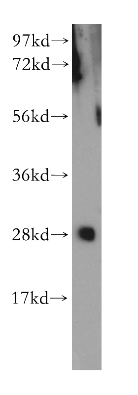 mouse skeletal muscle tissue were subjected to SDS PAGE followed by western blot with Catalog No:111190(GSTO2 antibody) at dilution of 1:300