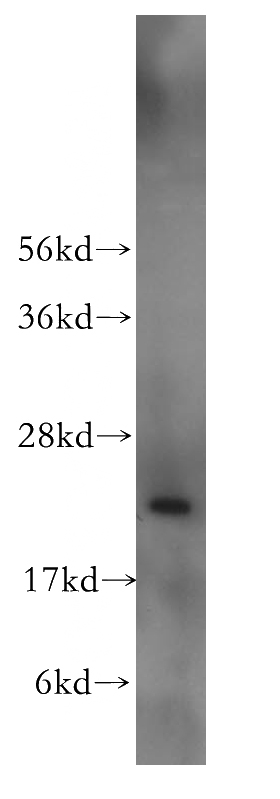 Y79 cells were subjected to SDS PAGE followed by western blot with Catalog No:115978(TAF12 antibody) at dilution of 1:300