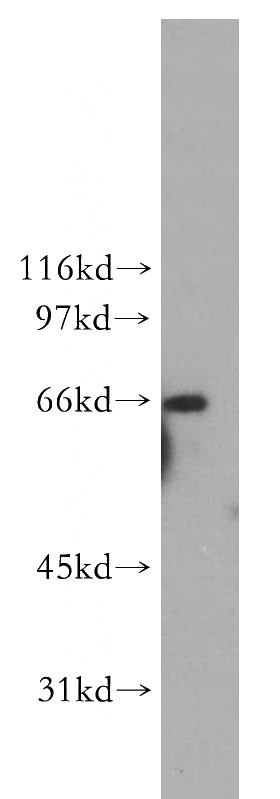 HeLa cells were subjected to SDS PAGE followed by western blot with Catalog No:114819(RPN1 antibody) at dilution of 1:500