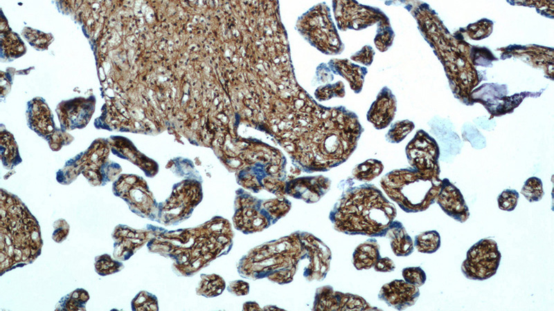 Immunohistochemistry of paraffin-embedded human placenta tissue slide using Catalog No:111449(PGDS Antibody) at dilution of 1:50 (under 10x lens)