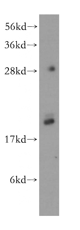 human colon tissue were subjected to SDS PAGE followed by western blot with Catalog No:112970(MYL9 antibody) at dilution of 1:400