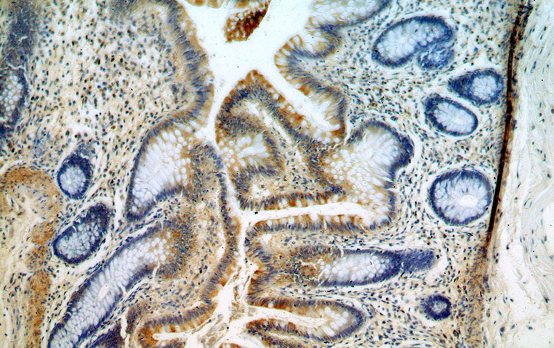 Immunohistochemical of paraffin-embedded human colon using Catalog No:113135(NRTN-Specific antibody) at dilution of 1:50 (under 10x lens)
