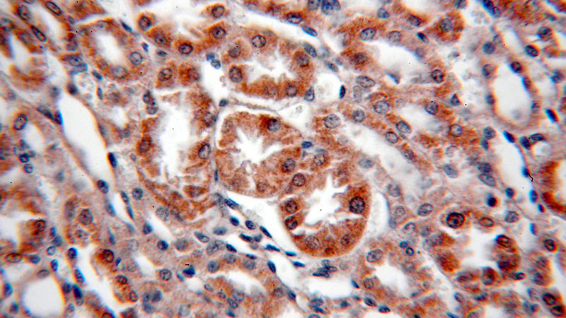 Immunohistochemical of paraffin-embedded human kidney using Catalog No:115582(SREBF2 antibody) at dilution of 1:50 (under 40x lens)