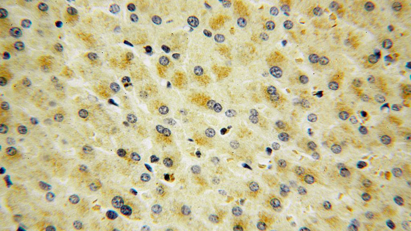 Immunohistochemical of paraffin-embedded human liver using Catalog No:115426(SMAP2 antibody) at dilution of 1:50 (under 40x lens)