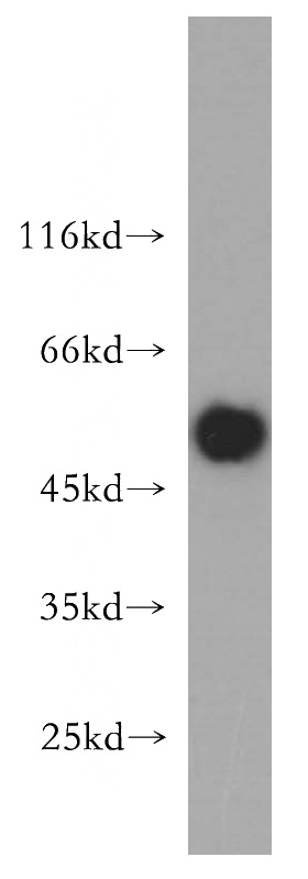mouse brain tissue were subjected to SDS PAGE followed by western blot with Catalog No:112668(MKP-2 antibody) at dilution of 1:500