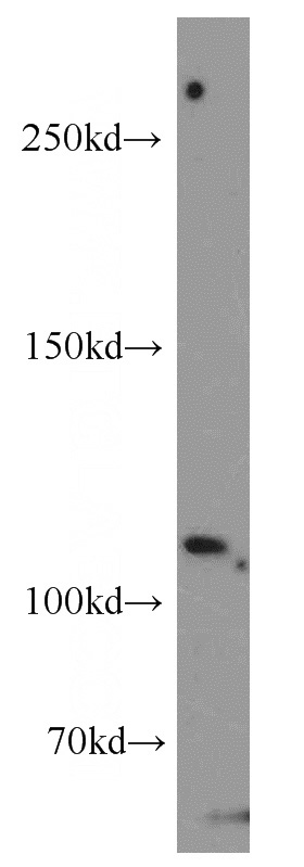 Jurkat cells were subjected to SDS PAGE followed by western blot with Catalog No:115091(EXoc4 antibody) at dilution of 1:300