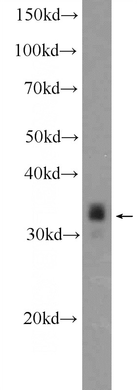 Neuro-2a cells were subjected to SDS PAGE followed by western blot with Catalog No:113862(PHOX2B Antibody) at dilution of 1:1000