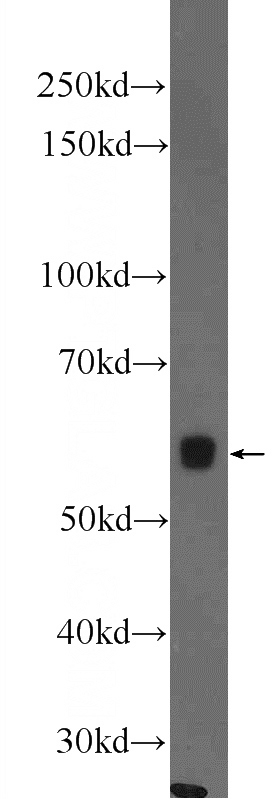 rat testis tissue were subjected to SDS PAGE followed by western blot with Catalog No:112717(MNS1 Antibody) at dilution of 1:1000