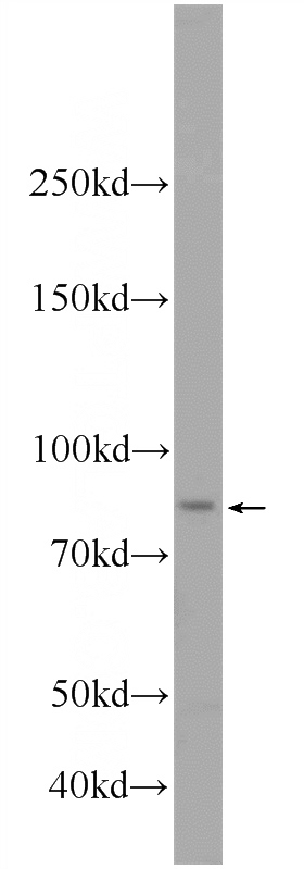 A375 cells were subjected to SDS PAGE followed by western blot with Catalog No:116810(VWA2 Antibody) at dilution of 1:600