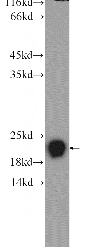 HepG2 cells were subjected to SDS PAGE followed by western blot with Catalog No:114847(RSL24D1 Antibody) at dilution of 1:600