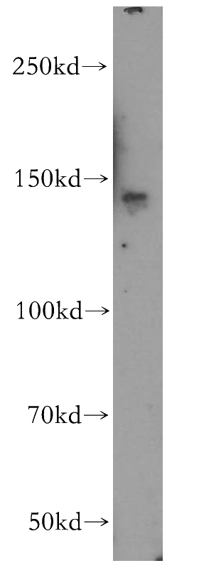 mouse brain tissue were subjected to SDS PAGE followed by western blot with Catalog No:115412(SLTM antibody) at dilution of 1:500