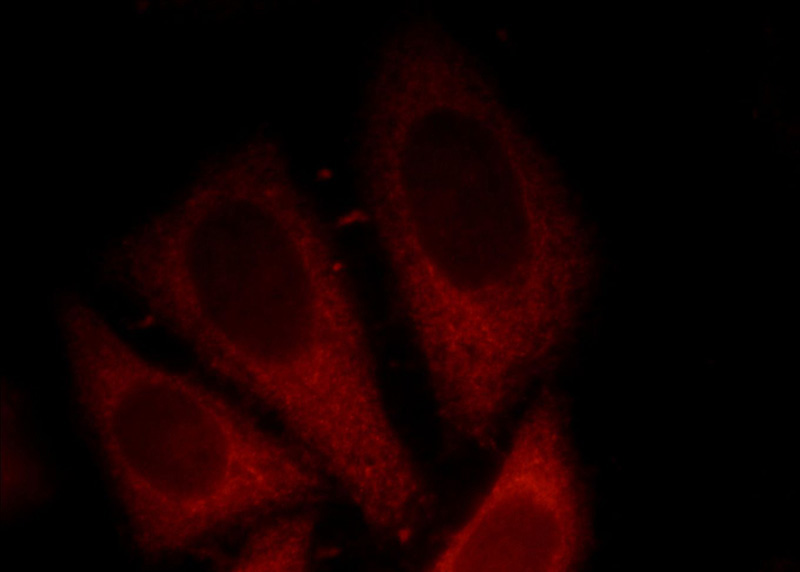 Immunofluorescent analysis of HepG2 cells, using CTNND1 antibody Catalog No:113533 at 1:25 dilution and Rhodamine-labeled goat anti-rabbit IgG (red).