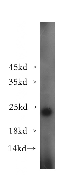 MCF7 cells were subjected to SDS PAGE followed by western blot with Catalog No:115619(SSX4 antibody) at dilution of 1:1000