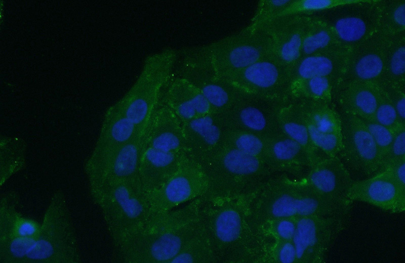 Immunofluorescent analysis of (10% Formaldehyde) fixed A549 cells using Catalog No:111866(Integrin beta-6-Specific Antibody) at dilution of 1:50 and Alexa Fluor 488-congugated AffiniPure Goat Anti-Rabbit IgG(H+L)