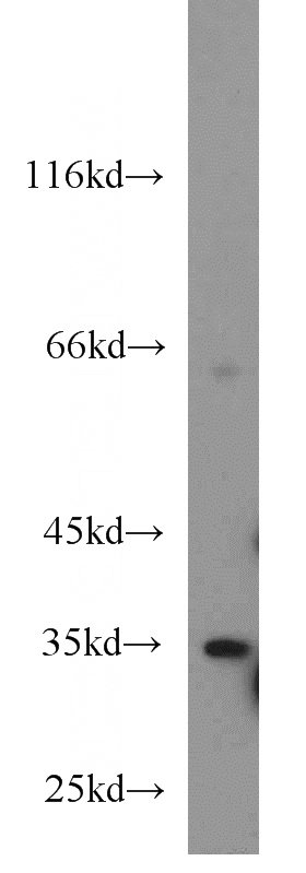 K-562 cells were subjected to SDS PAGE followed by western blot with Catalog No:109865(CD234 antibody) at dilution of 1:500