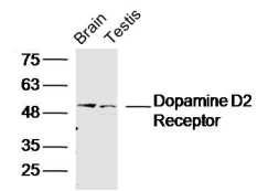 Fig2: Sample:; Brain (Mouse) Lysate at 40 ug; Testis (Mouse) Lysate at 40 ug; Primary: Anti- Dopamine D5 receptor at 1/300 dilution; Secondary: IRDye800CW Goat Anti-Rabbit IgG at 1/20000 dilution; Predicted band size: 53kD; Observed band size: 53kD