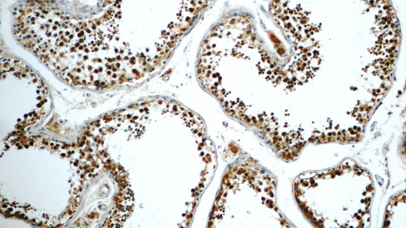 Immunohistochemistry of paraffin-embedded human testis tissue slide using Catalog No:113685(PCBP2 Antibody) at dilution of 1:50 (under 10x lens)