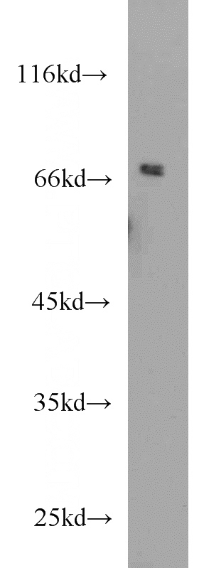 HeLa cells were subjected to SDS PAGE followed by western blot with Catalog No:115469(SNX1 antibody) at dilution of 1:1000