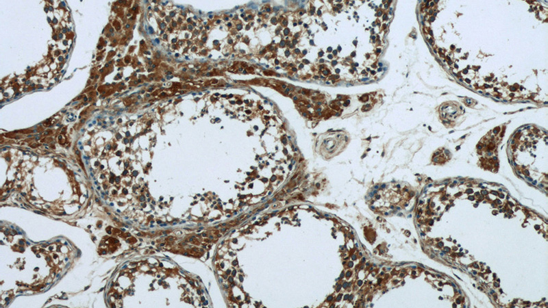 Immunohistochemistry of paraffin-embedded human testis tissue slide using Catalog No:110502(SEC10 Antibody) at dilution of 1:50 (under 10x lens)