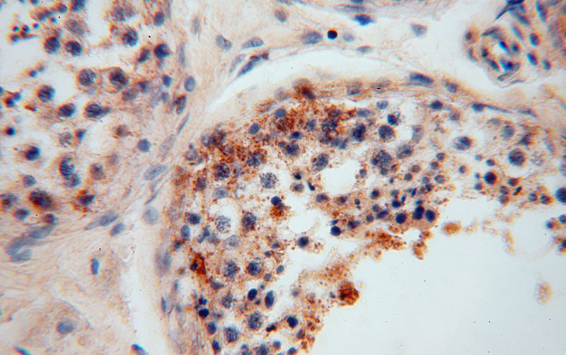 Immunohistochemical of paraffin-embedded human testis using Catalog No:113275(NRD1 antibody) at dilution of 1:50 (under 40x lens)