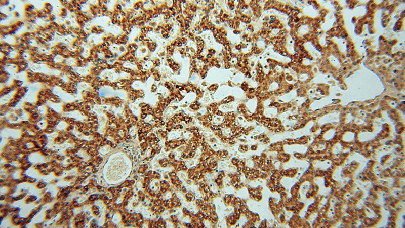 Immunohistochemical of paraffin-embedded human liver using Catalog No:113467(ocIAD1 antibody) at dilution of 1:100 (under 10x lens)