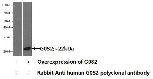 Transfected HEK-293 cells were subjected to SDS PAGE followed by western blot with Catalog No:110762(G0S2 Antibody) at dilution of 1:1000