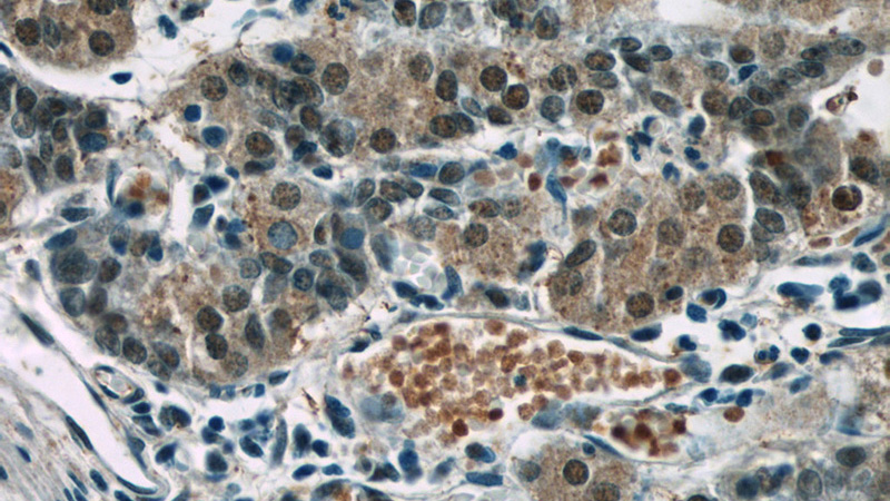 Immunohistochemistry of paraffin-embedded human stomach tissue slide using Catalog No:109630(CWC15 Antibody) at dilution of 1:50 (under 40x lens)
