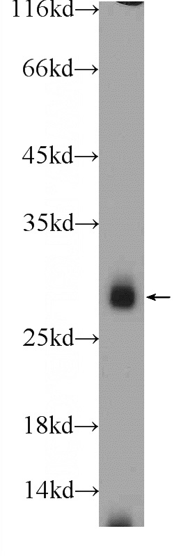 MDA-MB-453s cells were subjected to SDS PAGE followed by western blot with Catalog No:111780(IL22RA2 Antibody) at dilution of 1:600