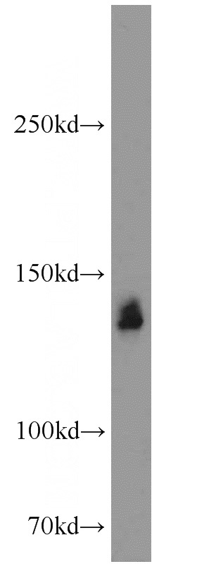 mouse liver tissue were subjected to SDS PAGE followed by western blot with Catalog No:115601(SRRM1 antibody) at dilution of 1:500