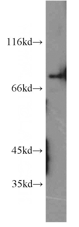 human brain tissue were subjected to SDS PAGE followed by western blot with Catalog No:113851(PRKCG antibody) at dilution of 1:1000