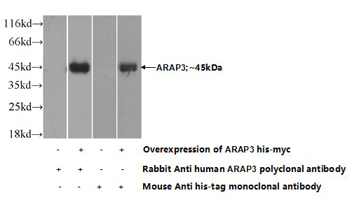 Transfected HEK-293 cells were subjected to SDS PAGE followed by western blot with Catalog No:108237(ARAP3 Antibody) at dilution of 1:700