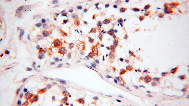 Immunohistochemical of paraffin-embedded human testis using Catalog No:110678(FKBP6 antibody) at dilution of 1:100 (under 40x lens)