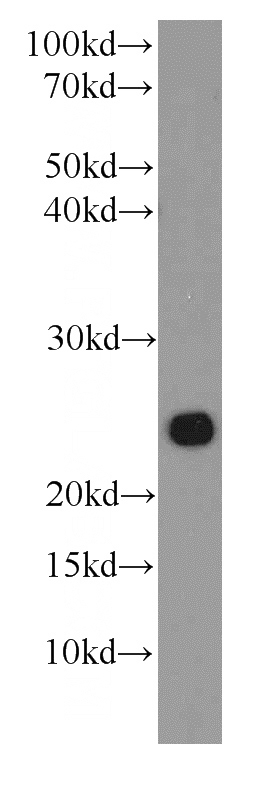 HeLa cells were subjected to SDS PAGE followed by western blot with Catalog No:107303(GOSR2 antibody) at dilution of 1:1000