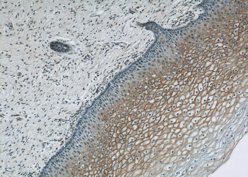 Immunohistochemical of paraffin-embedded human cervix using Catalog No:116028(TGM1 antibody) at dilution of 1:200 (under 10x lens)