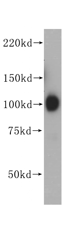 HeLa cells were subjected to SDS PAGE followed by western blot with Catalog No:111223(HSP90B1 antibody) at dilution of 1:500