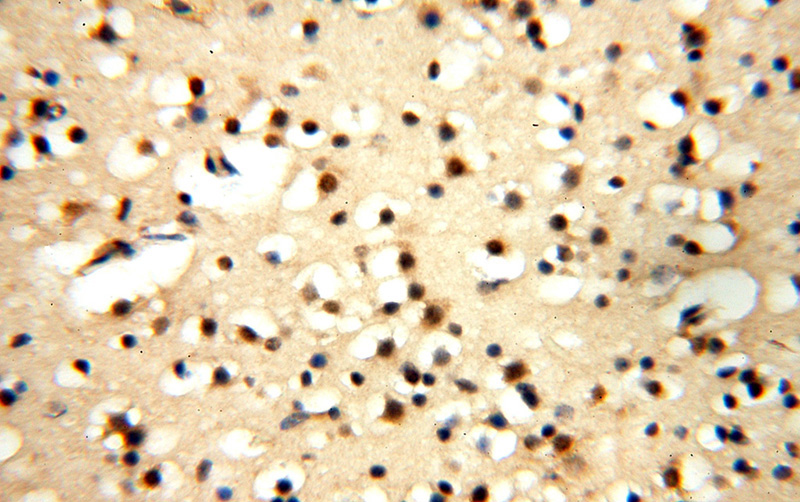 Immunohistochemical of paraffin-embedded human brain using Catalog No:113625(PDK2 antibody) at dilution of 1:100 (under 40x lens)