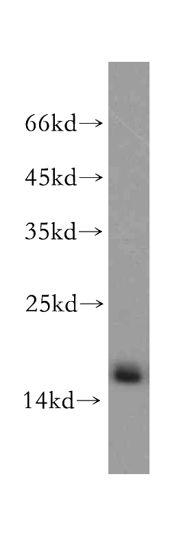 A2780 cells were subjected to SDS PAGE followed by western blot with Catalog No:115461(SNRPD2 antibody) at dilution of 1:500