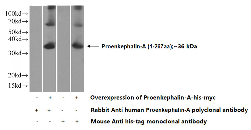 Transfected HEK-293 cells were subjected to SDS PAGE followed by western blot with Catalog No:114213(PENK Antibody) at dilution of 1:1000
