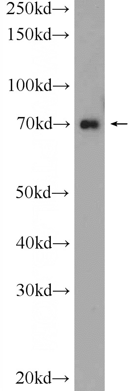 HeLa cells were subjected to SDS PAGE followed by western blot with Catalog No:111444(HP1BP3 Antibody) at dilution of 1:600