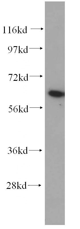 HeLa cells were subjected to SDS PAGE followed by western blot with Catalog No:107948(AKT antibody) at dilution of 1:500