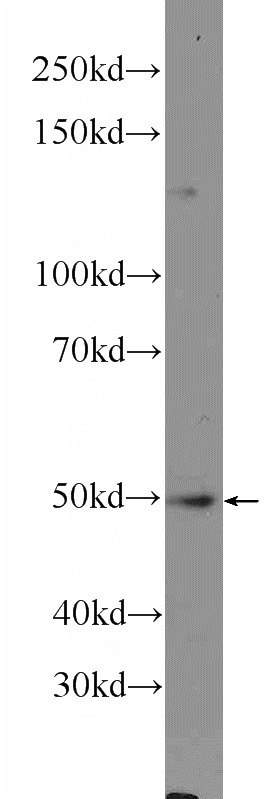 BxPC-3 cells were subjected to SDS PAGE followed by western blot with Catalog No:113238(NLE1 Antibody) at dilution of 1:300